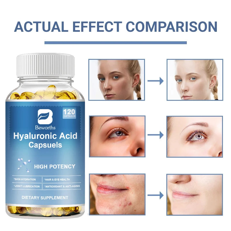 Hyaluronic Acid Capsules